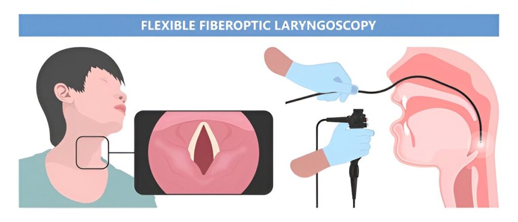 Laryngoscopy