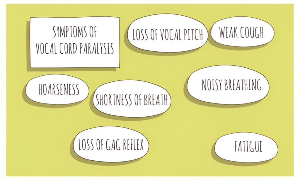 Symptoms of Vocal Cord Paralysis