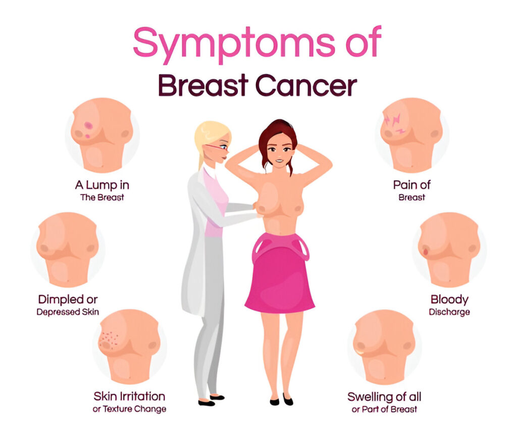 breast-cancer-symptoms-flat-infographic-vector