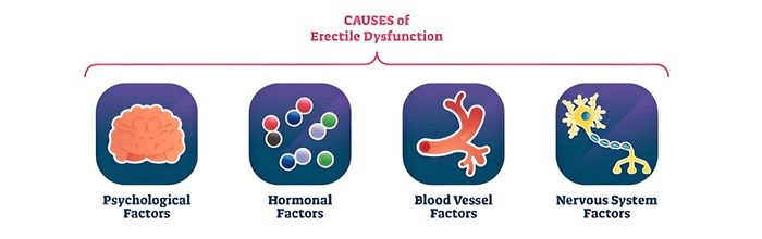 Causes of Erectile Dysfunction 