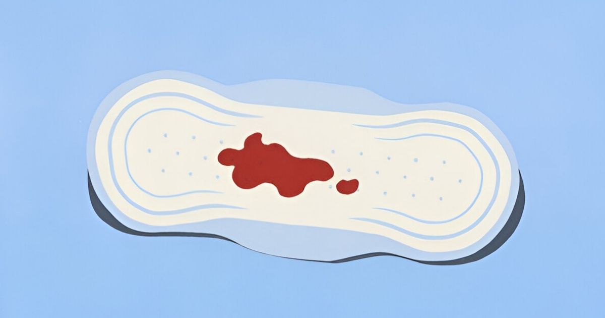 irregular menstruation