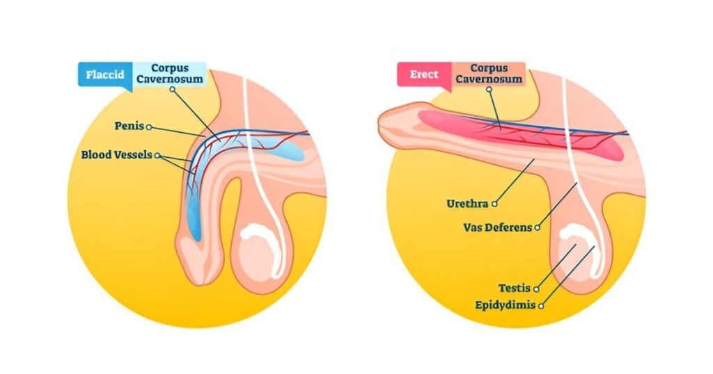 erectile dysfunction