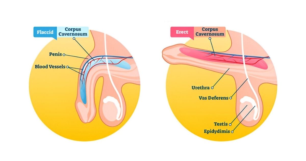 erectile dysfunction